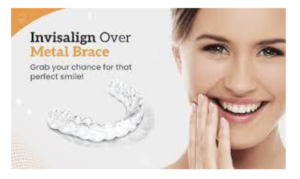 Invisalign Orthodontic Treatment